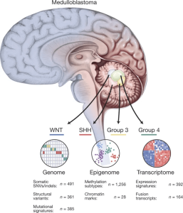 Medulloblastoma