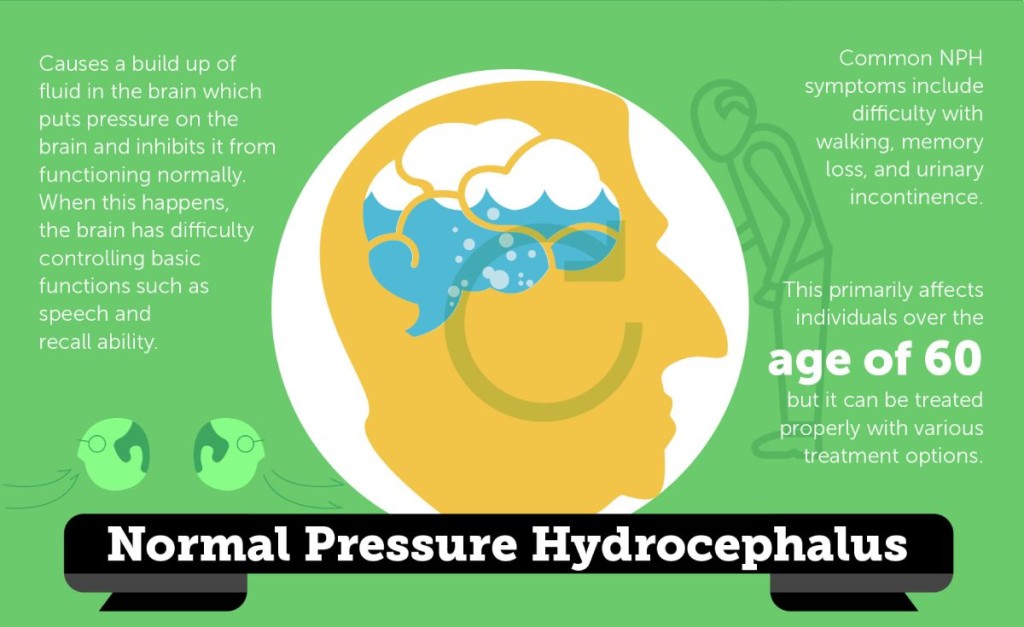 Normal-Pressure Hydrocephalus